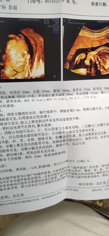 journal_insert_pic_1690091619