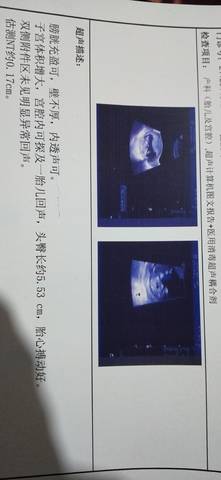 journal_insert_pic_1686625057