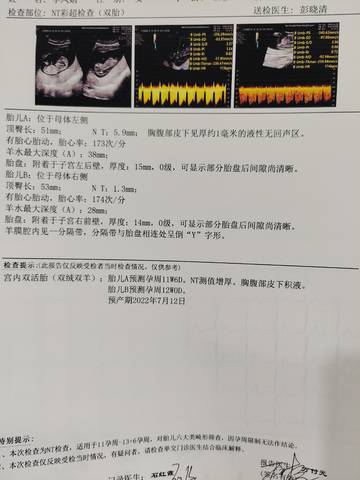 journal_insert_pic_1687799964