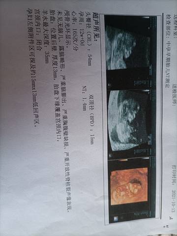 journal_insert_pic_1674094056