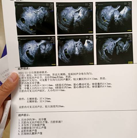 journal_insert_pic_1690014347