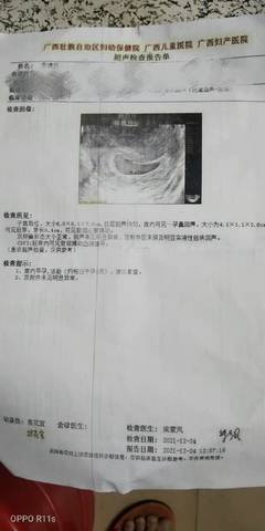 journal_insert_pic_1685465670