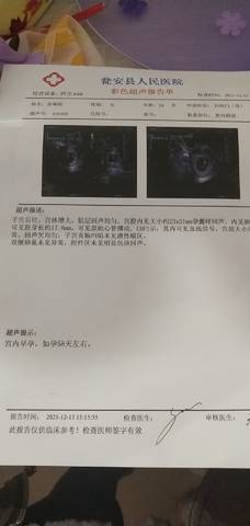 journal_insert_pic_1682488854