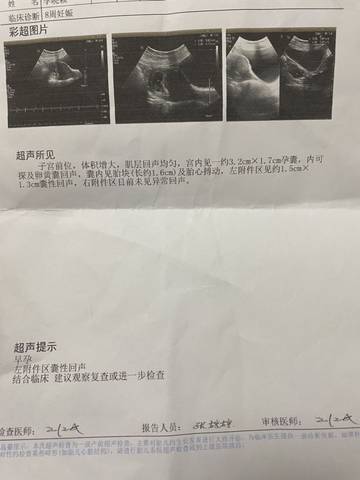 journal_insert_pic_1683825906