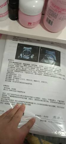 journal_insert_pic_1673914192