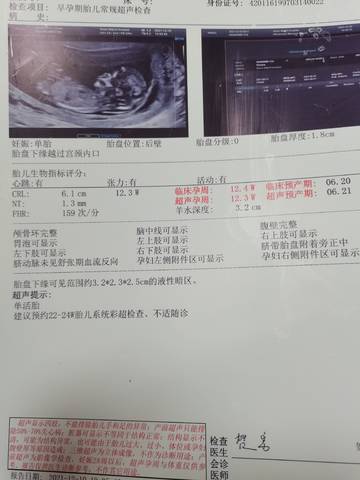 journal_insert_pic_1678689903