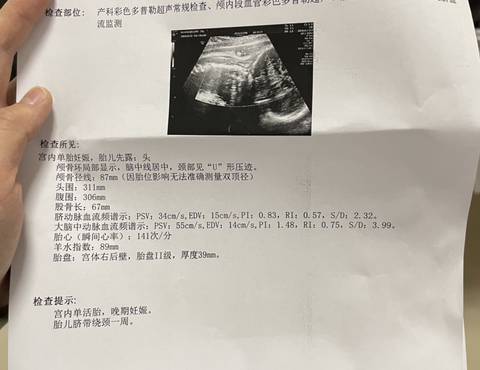 journal_insert_pic_1674660525