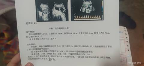 journal_insert_pic_1689176893