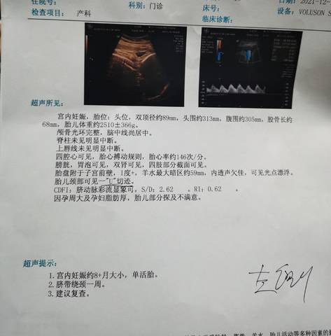 journal_insert_pic_1682131654