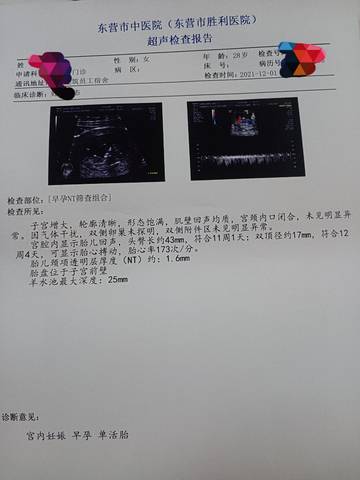 journal_insert_pic_1674308301