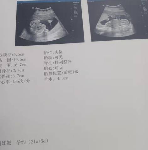 journal_insert_pic_1683111474
