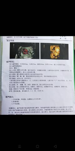 journal_insert_pic_1684222659