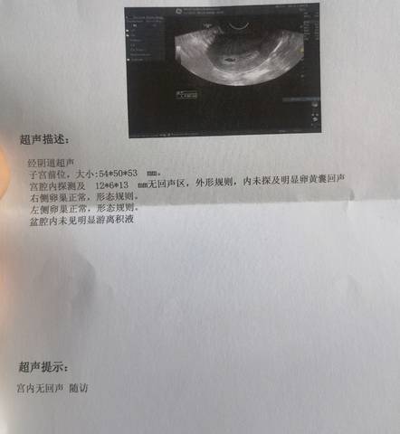 journal_insert_pic_1688338103