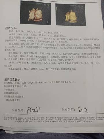 journal_insert_pic_1678119513