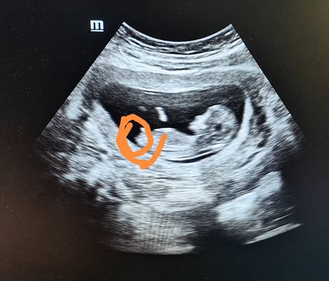 journal_insert_pic_1689970560