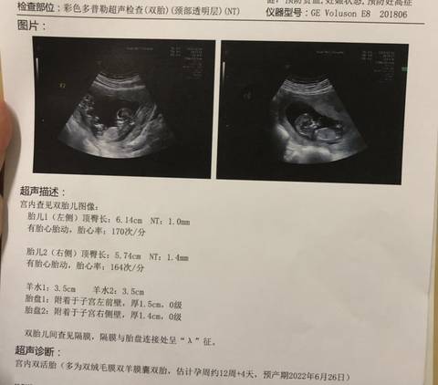 journal_insert_pic_1681136250