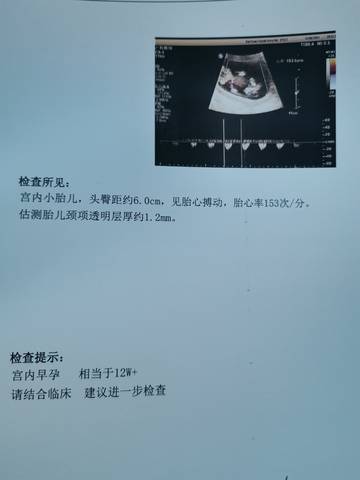 journal_insert_pic_1675072307