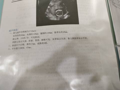 journal_insert_pic_1675330054