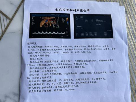 journal_insert_pic_1674325297