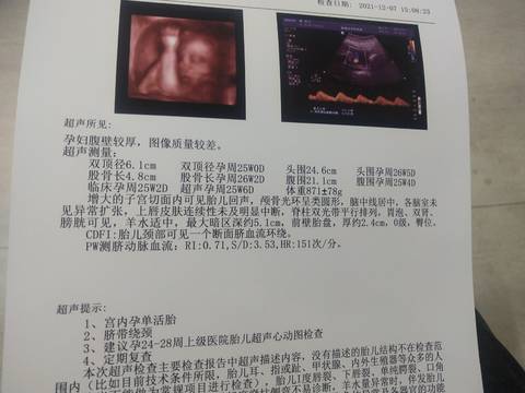 journal_insert_pic_1682941186