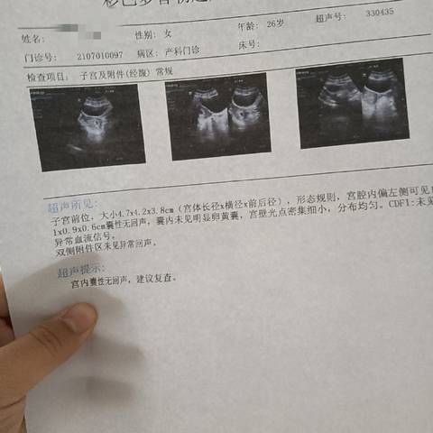 journal_insert_pic_1685150703