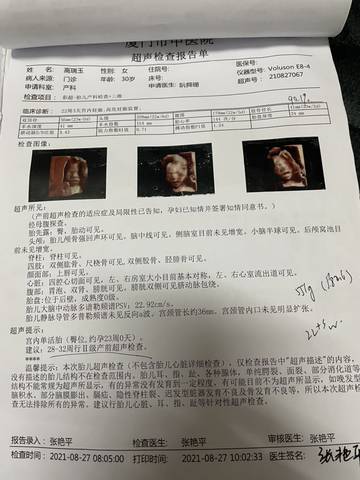 journal_insert_pic_1678049534