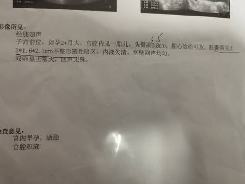 journal_insert_pic_1673085798