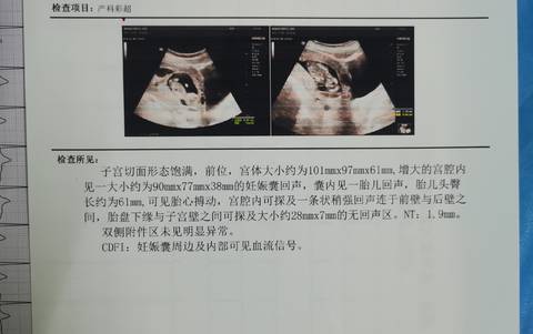 journal_insert_pic_1683908899