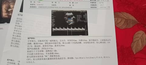 journal_insert_pic_1684034183