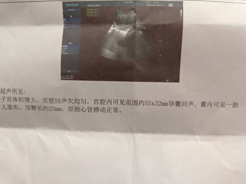 journal_insert_pic_1741014907