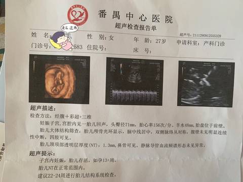 journal_insert_pic_1673852636
