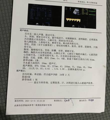 journal_insert_pic_1689744262