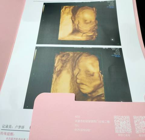 journal_insert_pic_1688346643