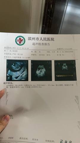 journal_insert_pic_1681387001