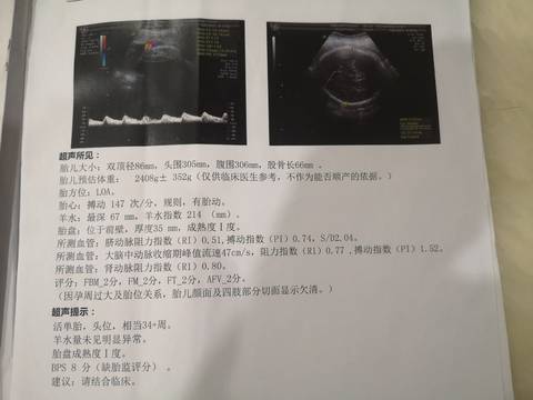 journal_insert_pic_1678953443