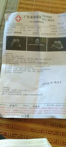 journal_insert_pic_1674345351