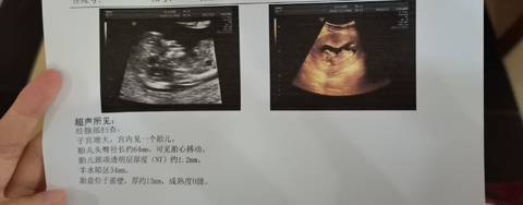 journal_insert_pic_1681861180