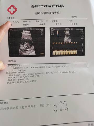 journal_insert_pic_1688937641