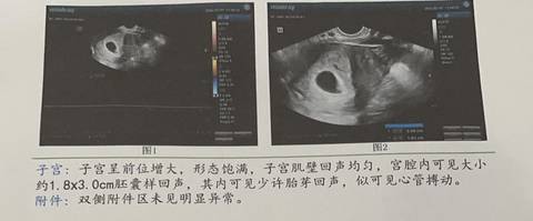 journal_insert_pic_1690302927