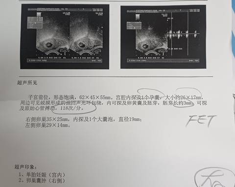 journal_insert_pic_1681904928