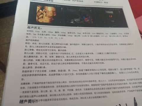 journal_insert_pic_1688418752