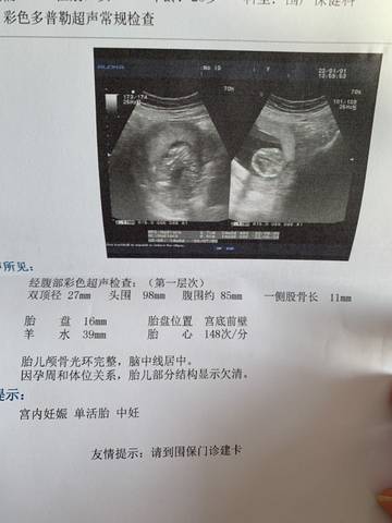 journal_insert_pic_1690552845