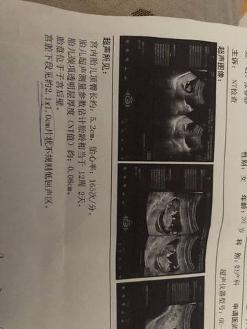 journal_insert_pic_1684785152
