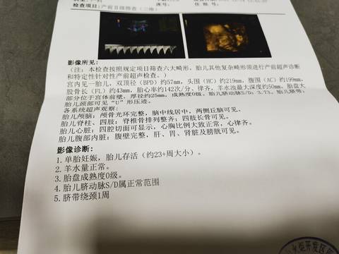 journal_insert_pic_1679831362