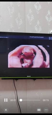 journal_insert_pic_1681322766