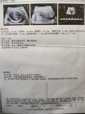 journal_insert_pic_1673498328