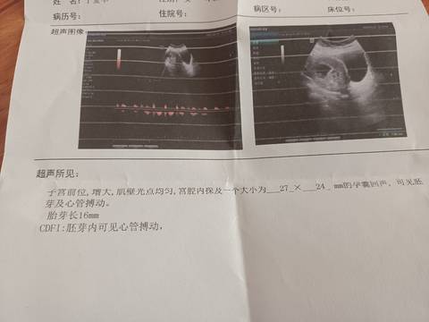 journal_insert_pic_1740858842