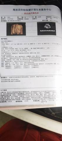 journal_insert_pic_1690581510