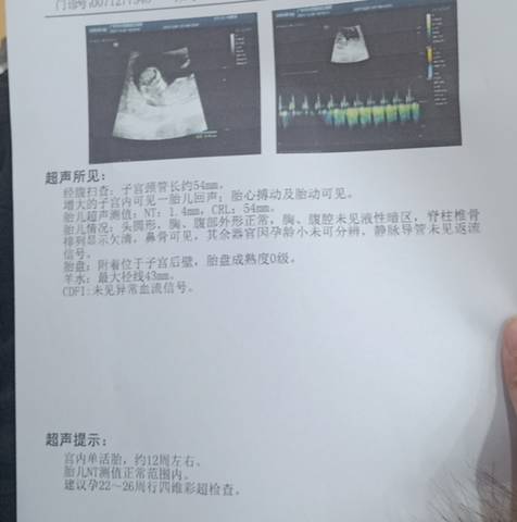 journal_insert_pic_1689009351