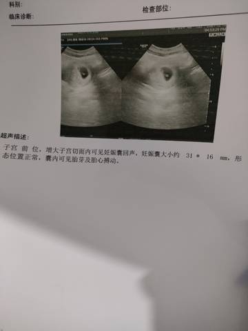 journal_insert_pic_1682228932